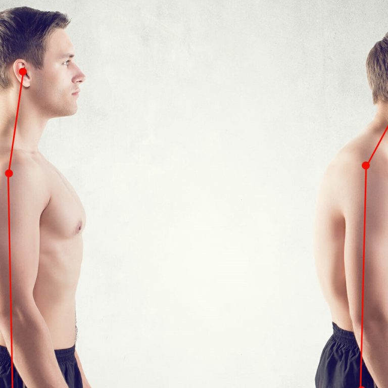 posture-image-with-plumb-line-cropped